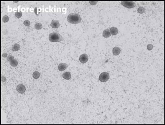 Isolation of adherent colonies: image before picking