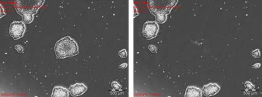 Isolation of a stem cell colony: before and after picking images