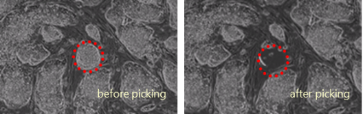 hESC on feeder cells: before and after picking