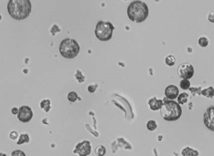 Hellfeld: Picken von Protoplasten mit dem ALS CellCelector Bild nach dem Picken Hellfeld: Picken von Protoplasten mit dem ALS CellCelector Bild nach dem Picken