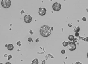 Hellfeld: Picken von Protoplasten mit dem ALS CellCelector Bild vor dem Picken Hellfeld: Picken von Protoplasten mit dem ALS CellCelector Bild vor dem Picken