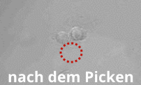 embryoid bodies nach dem Picken