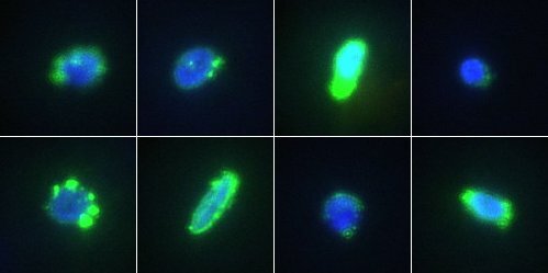 Galerie einzelner fetaler Zellen detektiert mit dem ALS CellCelector