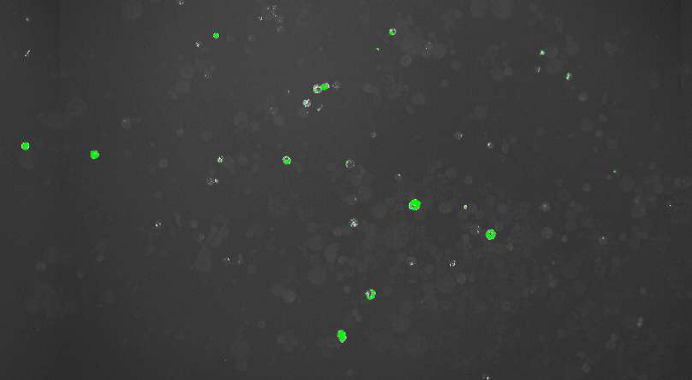 Fluoreszierende Arabidopsis thaliana-Blattzellen neben nicht-fluoreszierenden Zellen Fluoreszierende Arabidopsis thaliana-Blattzellen neben nicht-fluoreszierenden Zellen