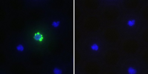 Isolierung einer einzelnen fetalen Zelle mit dem ALS CellCelector