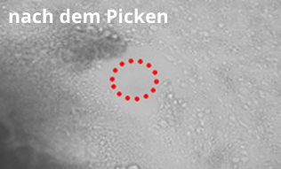 Picken spezieller Bereiche einer Stammzellkolonie: nach dem Picken Picken spezieller Bereiche einer Stammzellkolonie: nach dem Picken