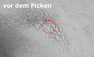 Picken spezieller Bereiche einer Stammzellkolonie: vor dem Picken Picken spezieller Bereiche einer Stammzellkolonie: vor dem Picken