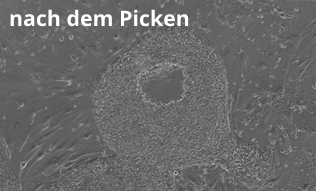 Picken spezieller Bereiche einer Stammzellkolonie: vor dem Picken Picken spezieller Bereiche einer Stammzellkolonie: vor dem Picken
