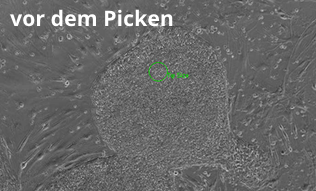 Picken spezieller Bereiche einer Stammzellkolonie: vor dem Picken Picken spezieller Bereiche einer Stammzellkolonie: vor dem Picken