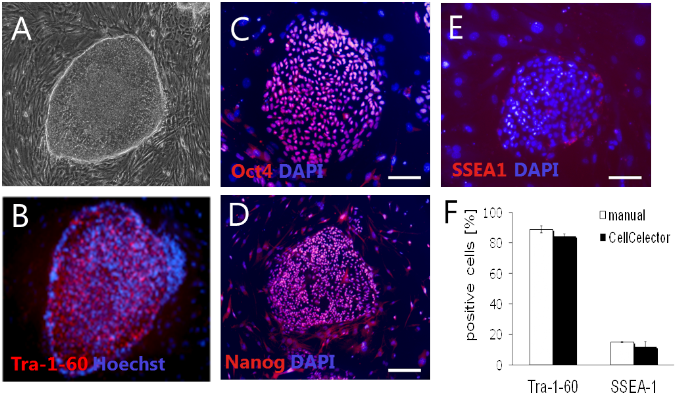 Immunozytochemische Färbung einer Kolonie Immunozytochemische Färbung einer Kolonie