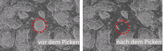 hESC auf Feeder-Zellen, vor und nach dem Picken hESC auf Feeder-Zellen, vor und nach dem Picken