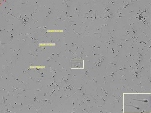 Single sperm cells in bright field illumination mode Single sperm cells in bright field illumination mode