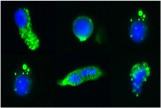 Gallery of fetal cells (trophoblasts) enriched and detected from maternal blood