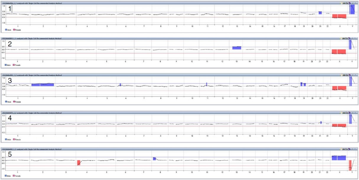 aCGH analysis of fetal cells - NIPT