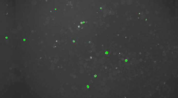 Fluorescent Arabidopsis thaliana leaf cells aside non-fluorescent cells