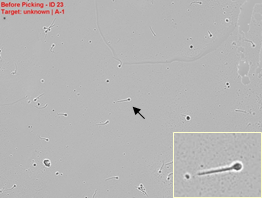 Image before picking of a single sperm cell Image before picking of a single sperm cell