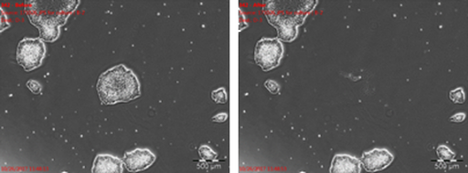 Isolation of a stem cell colony: before and after picking Isolation of a stem cell colony: before and after picking