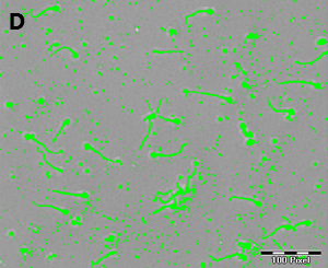 Detection of the complete sperm cell depending on the gray value defined in A