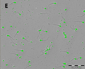 Detection of a part of the sperm cell depending on the gray value defined in B