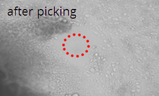 Isolation of already differentiated parts from an hESC colony: after picking Isolation of already differentiated parts from an hESC colony: after picking