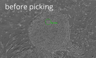 Transfer of specific, undifferentiated parts of a human embryonic stem cell (hESC) colony: before picking Transfer of specific, undifferentiated parts of a human embryonic stem cell (hESC) colony: before picking