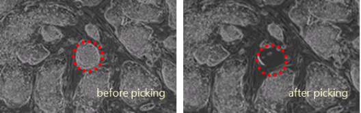 hESC on feeder cell: before and after picking hESC on feeder cell: before and after picking