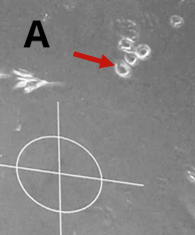 Daughter cells originating from one HSC Daughter cells originating from one HSC