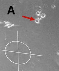 Daughter cells originating from one HSC