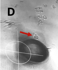 Target cell moved to the capillary