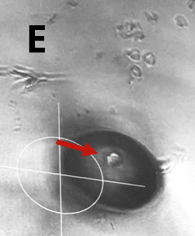 Gentle aspiration of the target cell Gentle aspiration of the target cell